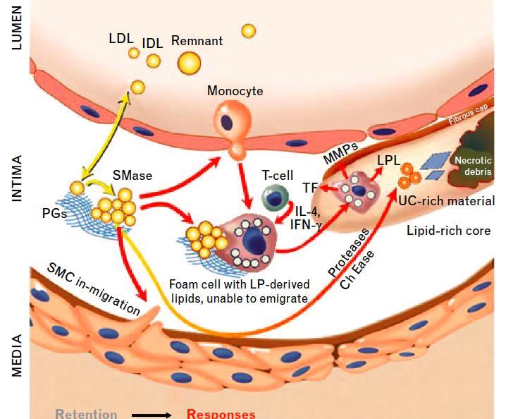 The central role of arterial retention of apob-containing lipoproteins in the