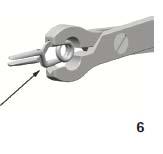 clip, correctly positioned 4 Yasargil aneurysm clip, incorrectly positioned 5 Yasargil aneurysm clip,