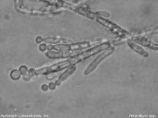 Results of Viable Mold Spores ID # S-01 Media MIA Location Basement Genus Found Aspergillus versicolor Penicillum spp. Cladosorium spp. Aspergillus nidulans Alterneria nidulas Chaetomium spp.