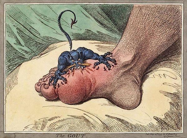 Gout: a disease of the blessed or a blessing in disguise?