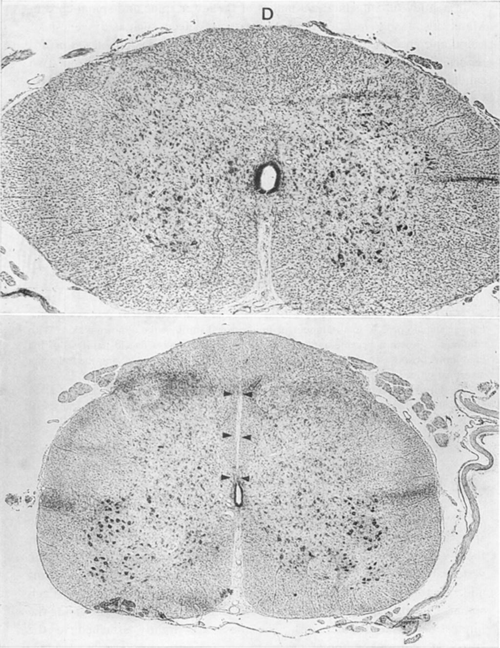 234 MARTIN 1 Fig. 1. Cross section of normal thoracic spinal cord. Thionin stain. Fig. 2.