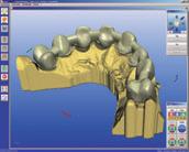 scanner stands for efficiency and flexibility in dental labs.