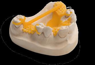 CAD/Cast partial denture frames VarseoWax CAD/Cast The resin for 3D printing of CAD/Cast partial denture frames and press-to-metal templates VarseoWax CAD/Cast can be burned out without leaving any