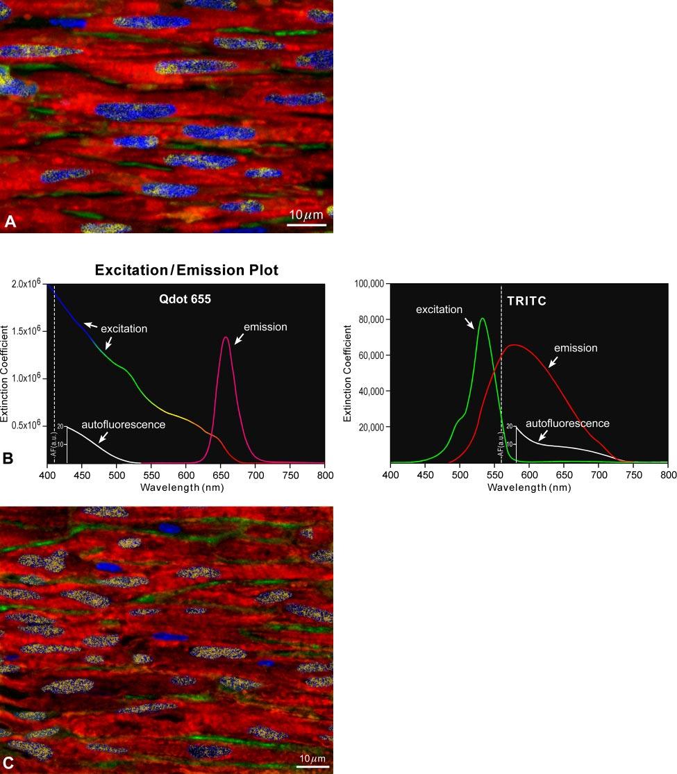 ADULT STEM CELLS 1387 FIG. 6. BMC transdifferentiation in the infarcted heart by quantum dot (Qdot) analysis.