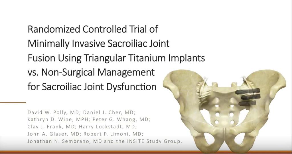 MINIMALLY INVASIVE SIJ FUSION VS NONSURGICAL MANAGEMENT improvements in pain and multiple health-related quality-of-life measures were found in those who underwent SIJ fusion compared with