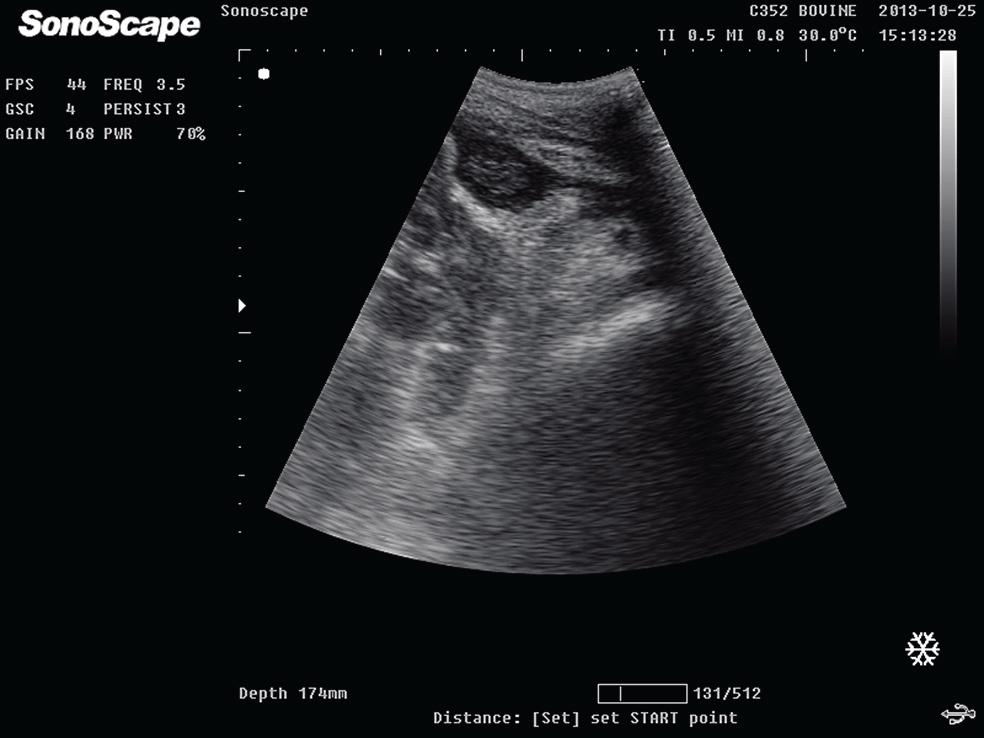Fig. 3. Ultrasound of zone four in patient 3 with post abomasopexy complications. Abscess cranial to the umbilicus and thickening of the abomasal wall are visible. The abscess measured 19.3 37.