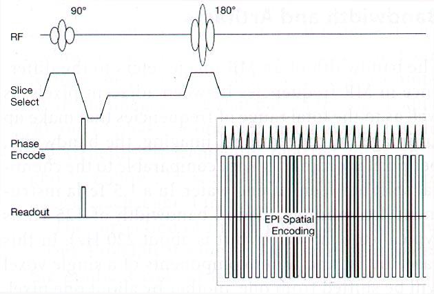 CHAPTER 2. METHODS Fig. 2-7: Example for an echo-planar pulse sequence. In contrast to the spin-echo sequence depicted in Fig.
