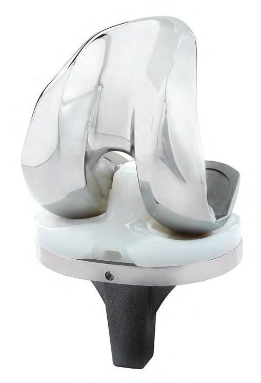 A An advanced approach to total knee replacement that introduces modern design features and intuitive instrumentation while building on the wisdom of a strong design lineage.