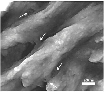 Bone building blocks Atomic Force Microscope collagen fibrils