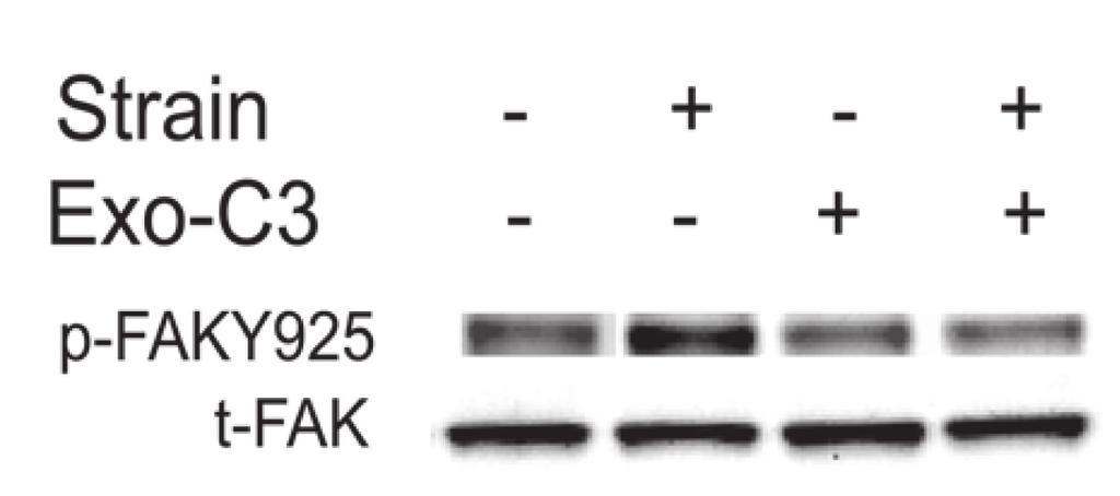 C1228 RhoA MEDIATES THE MOTOGENIC EFFECTS OF STRAIN IN Caco-2 CELLS Fig. 3. RhoA inhibition or reduction inhibits deformation-induced focal adhesion kinase (FAK)-Tyr 925, p38 phosphorylation.
