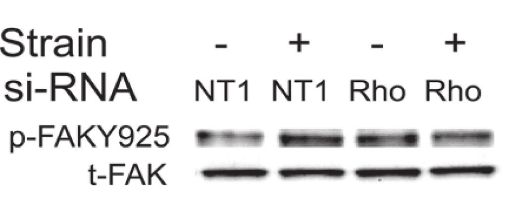 5 g/ml) or RhoA reduction by sirna on the phosphorylation of FAK at Tyr 925 (A and B) or p38 (C and D) were assessed by Western blot analysis of lysates from cells subjected to cyclic strain for 15