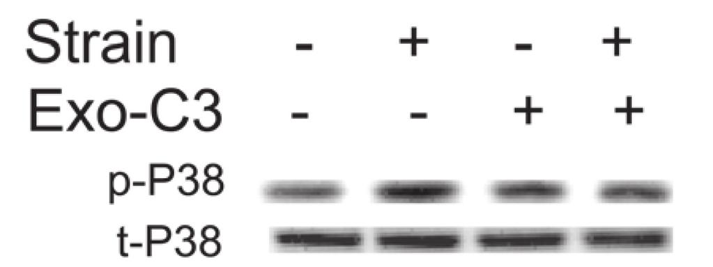 A: cyclic strain stimulates FAK-Tyr 925 phosphorylation in vehicle-treated cells (n 5, *P 0.05). Exoenzyme C3 completely blocked strain-induced FAK-Tyr 925 phosphorylation (n 5, *P 0.05). B: cyclic strain stimulates FAK-Tyr 925 phosphorylation in NT1-treated cells (n 5, *P 0.
