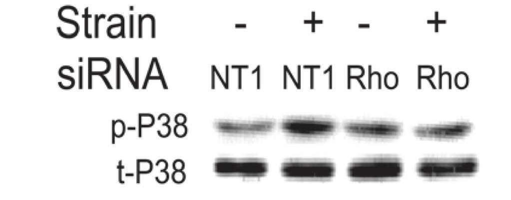 05). D: cyclic strain stimulates p38 phosphorylation in NT1-treated cells (n 5, *P 0.05). RhoA-reduced cells blocked strain-induced p38 phosphorylation (n 5, *P 0.05). exoenzyme C3 nor reducing RhoA by sirna blocked the deformation-induced increase in ERK phosphorylation in the cytoplasmic protein fraction (n 5, P 0.