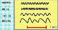 EEG and MEG EEG is an acronym for Electroencephalograph This is a recording ( graph ) of electrical signals ( electro ) from the brain ( encephalo ) electroencephalographs from humans: Hans Berger