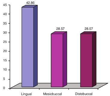 Of all the canals, 6 lingual, 4 mesiobuccal and 4 distobuccal were short of or exceeded the working length, corresponding to 9%, 6% and 6%, respectively, of a