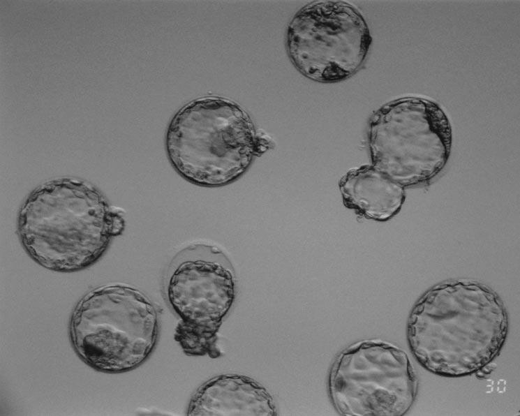 FIGURE 1 Photomicrograph of human blastocysts developed from donated oocytes on the morning of day 5. Four blastocysts can be seen to be hatching from the zona pellucida.