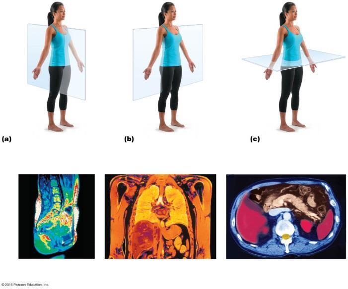 Project 7 - Planes and Sections Use fig 1.8 Planes of the Body Define and identify each of the following body planes.