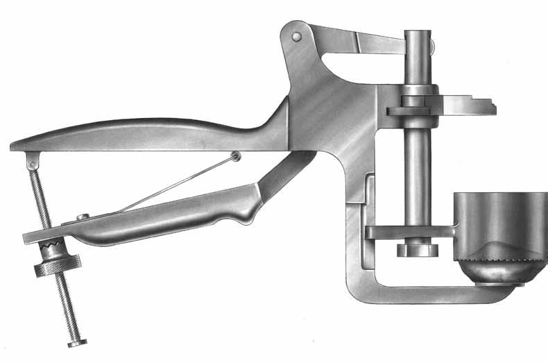 PATELLA PREPARATION Apply the Patella Reamer Clamp at a 90 angle to the longitudinal axis with the Patella Reamer Surfacing Guide encompassing the articular surface of the patella.