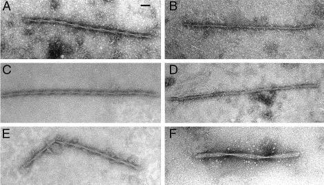 Figure 5-2. Electron micrographs of tau filaments (scale bar: 100nm). A: PHF in AD. B: straight filament in PSP. C: PHF in Down syndrome.