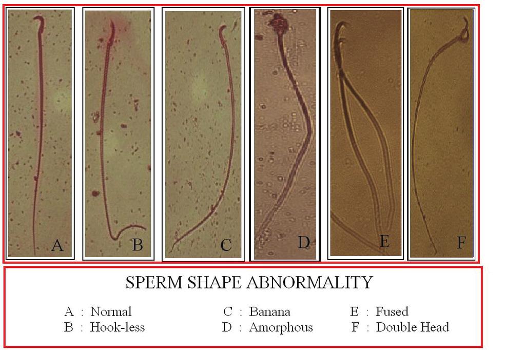 Rabbani et al Plate 2. Represents different types of sperm shape abnormality.