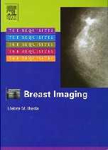 Interpretation of breast MRI American College of Radiology BI-RADS MRI lexicon Description of a mass: - Margin: smooth, irregular, spiculated - Shape: round, oval,