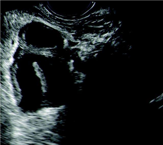 Role of Radiology Ultrasound technology is excellent to diagnose fetal growth restriction.