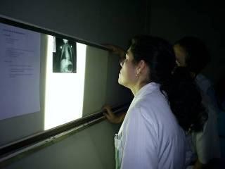 Role of Radiology Chest X rays are used for surveillance. Meaning, it is used to classify probable bacterial pneumonia.