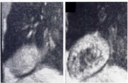 Gated images extend from lateral (left upper) to medial (right lower) aspect of left ventricle and provide visualization of its posterior and diaphragmatic walls.