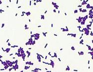 LISTERIA Listeria monocytogenes is a Gram-positive rod-shaped bacterium. L. monocytogenes can be isolated in soil, wood, and decaying matter in the natural environment.