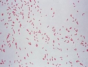 Wound and burn cultures and cultures from other body fluids and secretions according to the clinical scenario Gram stain and culture of CSF if meningitis is suspected Pseudomonas aeruginosa is member