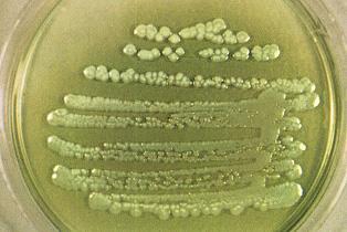 Pseudomonas aeruginosa on Deoxycholate Citrate Agar (lactose negative, H 2 S negative).