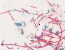 Bacillus anthracis -Wirtz-Conklin stain - bacterial spores stain green, vegetative cells stain red.