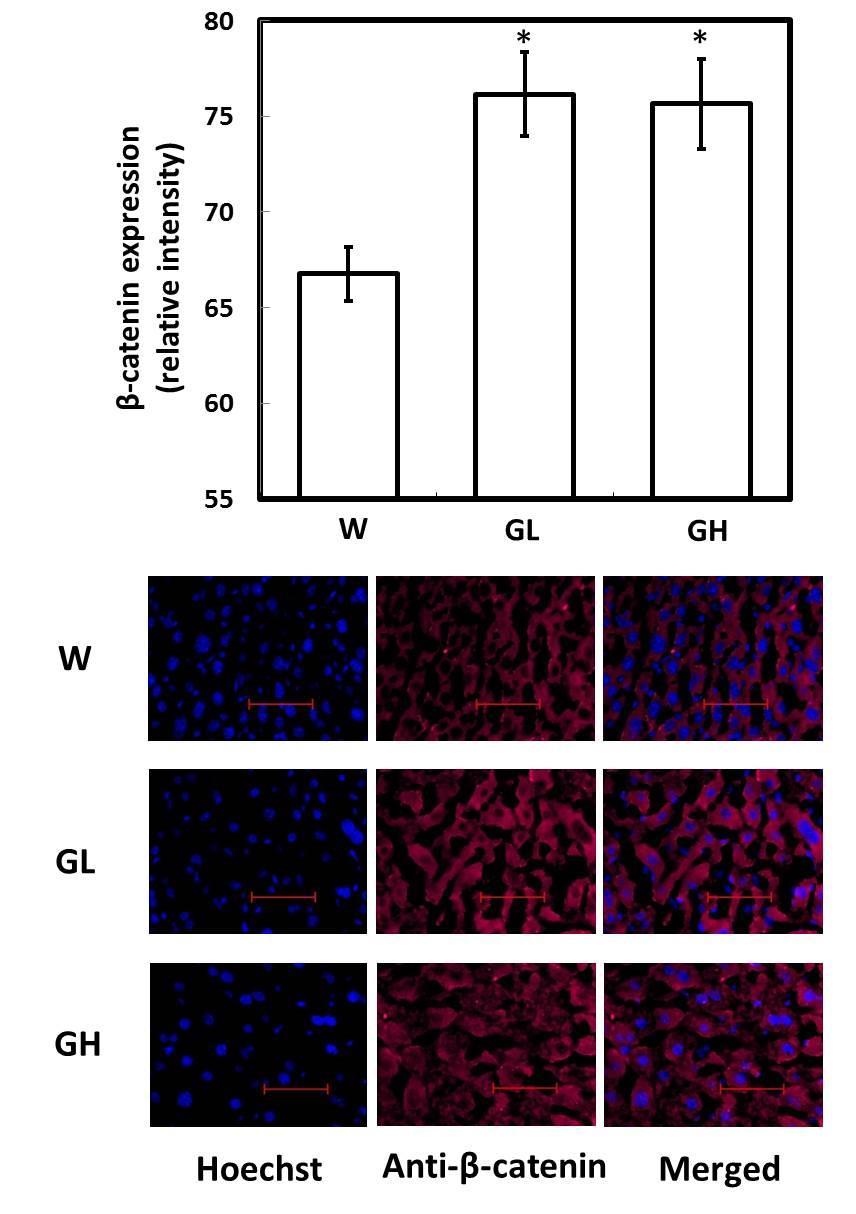 Figure 6.6 β-catenin immunofluorescence (IF) of metastasis-free liver sections. (A) Quantification of relative intensity of β-catenin signals.