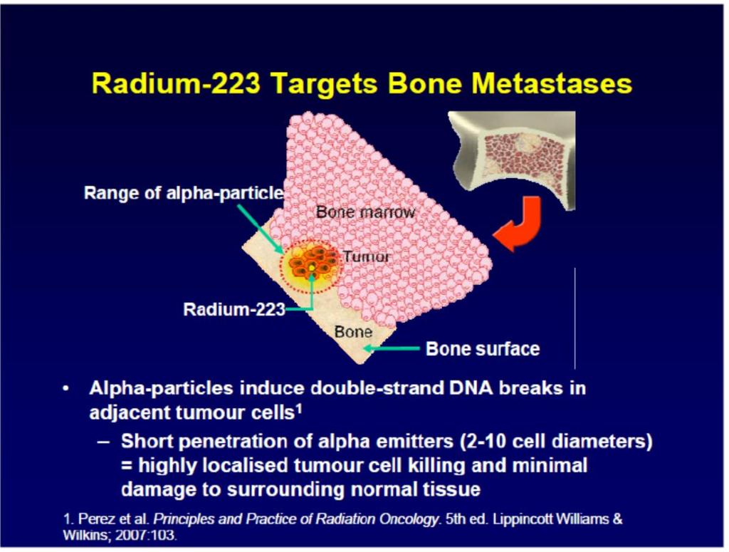 Bone targeted radiopharmaceuticals Radium 223 dicloride Alpha particle emitting agent; mimics Ca++ and forms hydroxyapatite at areas of increased bone turnover Indicated for