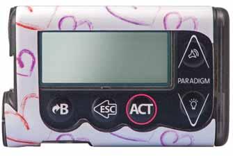 For many children, an insulin pump offers an ideal solution To deal with the challenges of keeping blood glucose levels under better control, many children with Type 1 diabetes rely on insulin pumps.