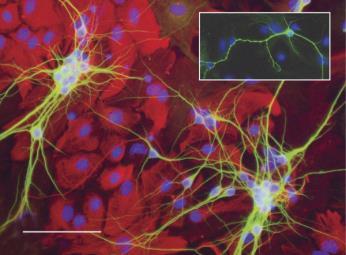 neuronal phenotype, and wild type astrocytes can rescue Fragile