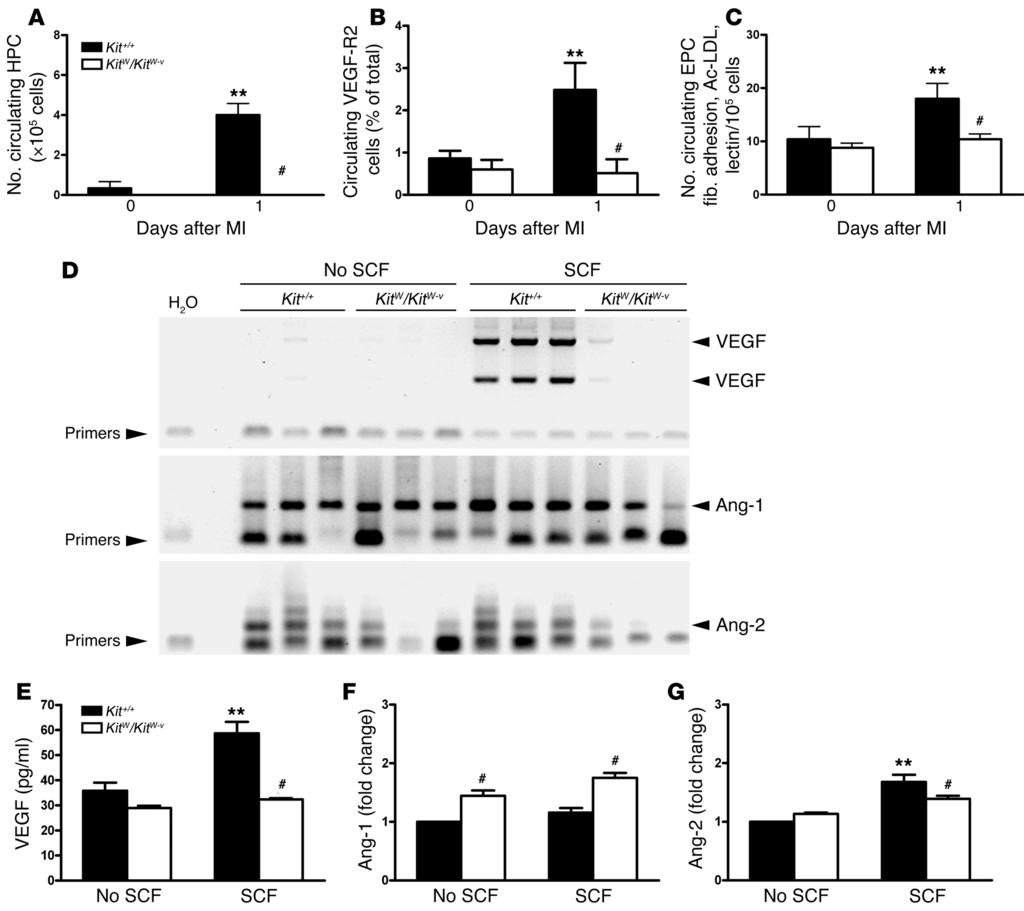 Figure 5 c-kit dysfunction is associated with abnormal EPC mobilization and function.