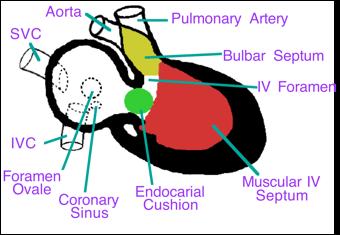 Ventricular Septation If you take a midsagital section through the interventricular septum and the endocardial cushion you would see the image above.