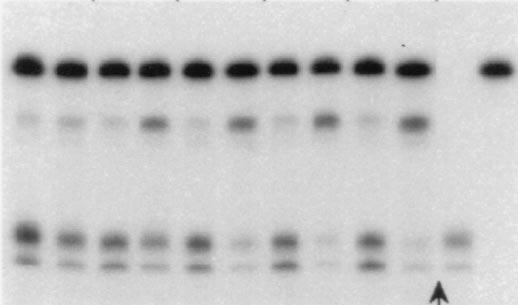 included in the cdna lanes. (C) As before, the probe 2 fragment protected by the reporter RNAs is labeled exon 5.