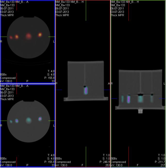 Trial 2 - SPECT Protocol Matrix size: 128x128 Step and shoot, autocontour 3 degrees/step TEW scatter compensation OSEM, 50 updates No post reconstruction filter