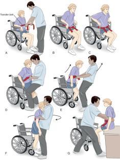 Assisted Standing Pivot Transfer FIG. 13-6 An assisted standing pivot transfer is used when transferring a patient from a wheelchair to a table. A, Use a transfer belt to hold the patient securely.