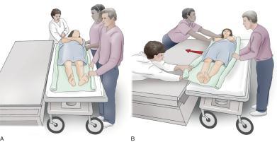Cart Transfers Make sure cart wheels are locked and immovable. Allow patient to assist with move based on the patient s ability and condition. Cart transfers usually require three people.