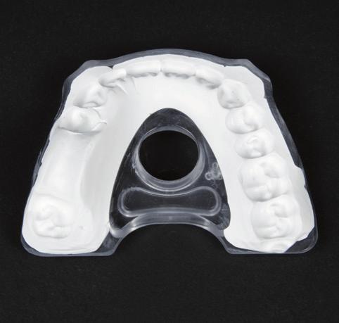 The holes ensure that the registration is retained on the bite plate. 2.3.3 Take the impression in the patient's mouth.