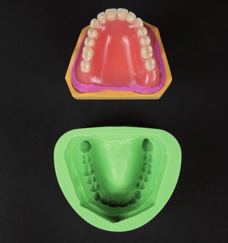 If there is no duplication form available, you can use silicone impression material (overcast material) as