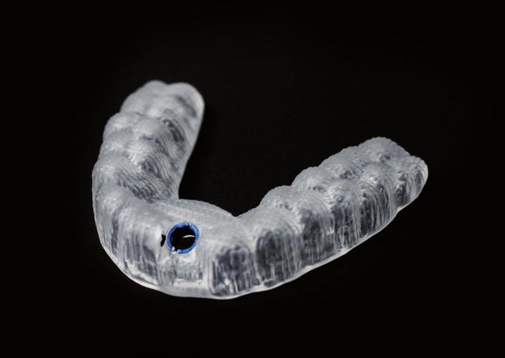 CLASSICGUIDEs are available teeth and mucosa supported with optional fixation using anchor pins, fixation screws or microimplants.