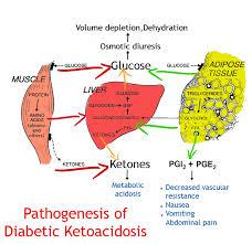 Anna s Cause of Death Ketoacidosis leads to diabetic coma death cells don t get enough glucose