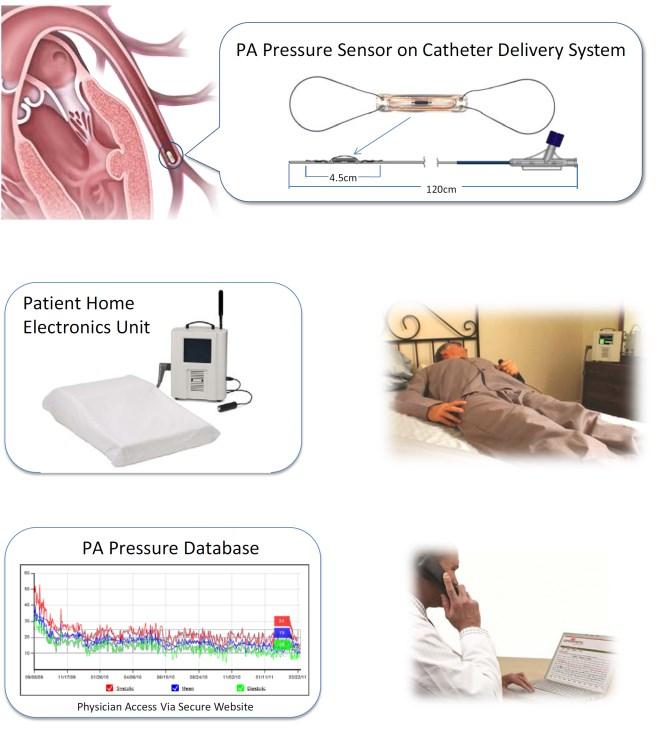 2. Brief description of the technology: The device can be implanted in the pulmonary artery of NYHA class III heart failure patients during a minimally invasive catheter based procedure.