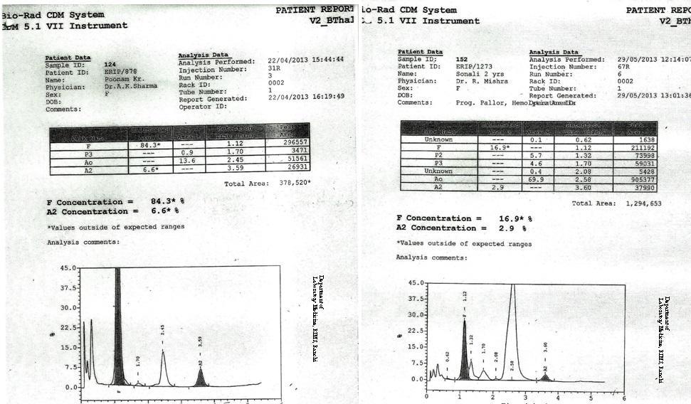 Department of Laboratory Medicine, RIMS Figure - 6 Chromatogram