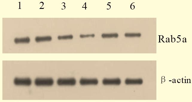 4 The Open Breast Cancer Journal, 2011, Volume 3 Cha et al. Fig. (3). Protein expression of Rab5a by Western Blot.