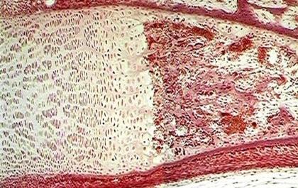 ( ) 3- Is penetrated by blood vessels ( ) 4- Matrix is normally mineralized ( ) 5- Has an extracellular matrix composed of collagen fibers and